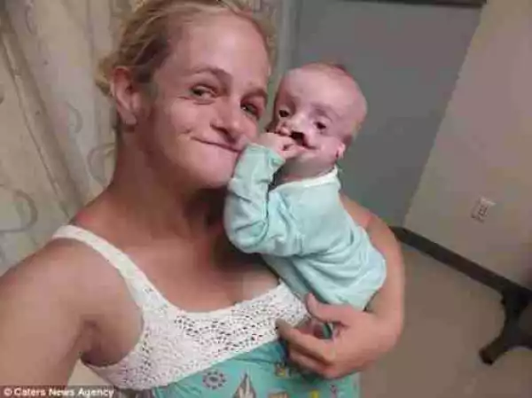Unbelievable: See the 8-month-old Baby Who Needs Surgery Every Six Months Until She